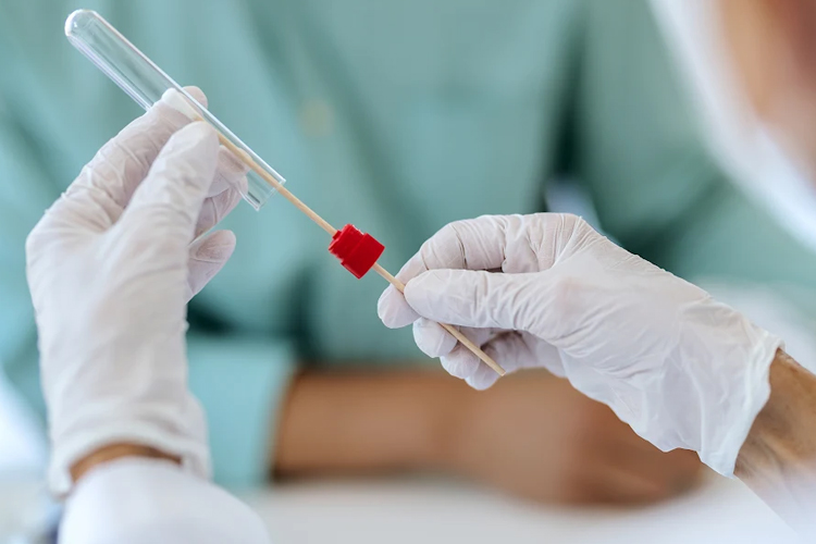 No‑Swab Strep Test for Kids: Painless Saliva PCR Diagnostics